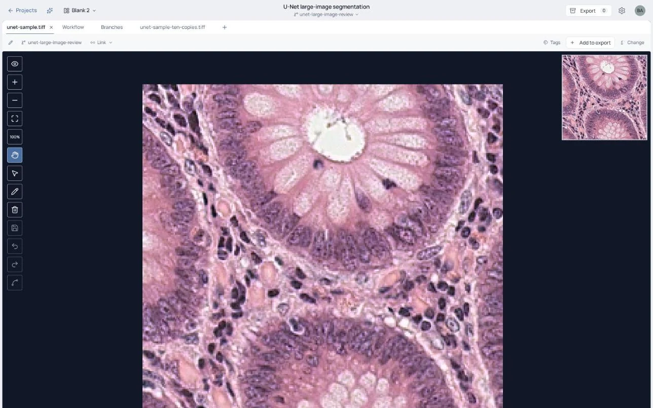 A histology image open in the BisQue viewer with its annotation tools.